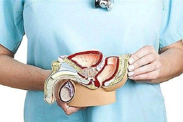 Prostat Hakkında Bilgi